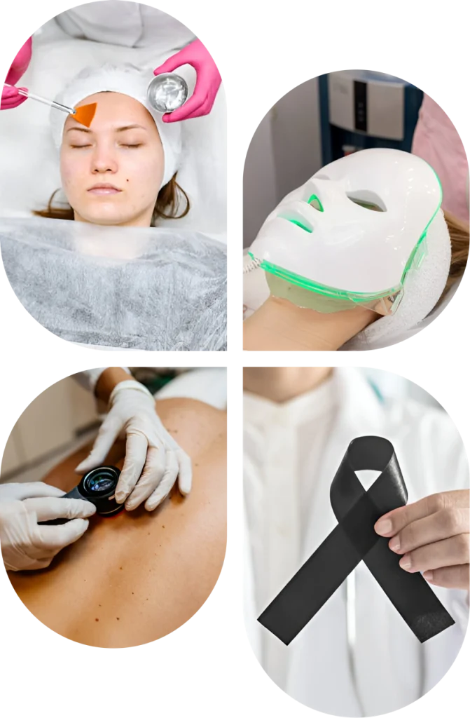 Skin Cancer Check Arundel