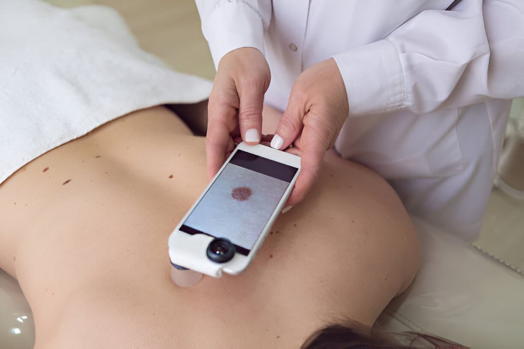 Skin Cancer Check Palm Beach