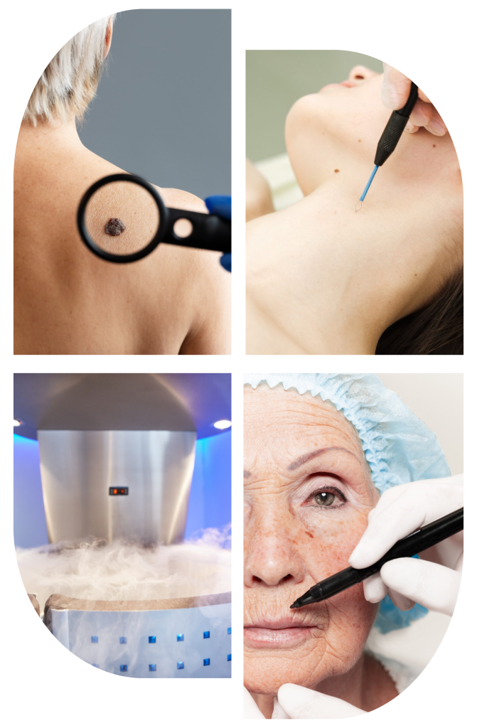 Skin Cancer Check Paradise Point